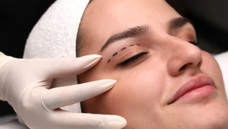 Çift Göz Kapağı Ameliyatı Nedir?